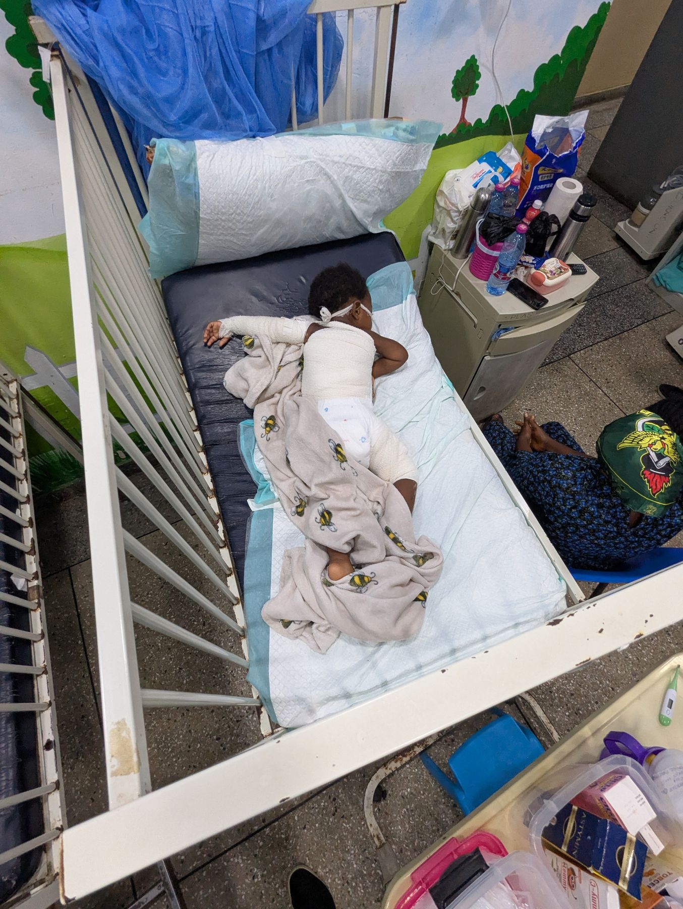 A young child resting in a hospital cot, arms bandaged after treatment